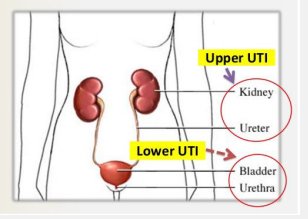 urinary tract infections